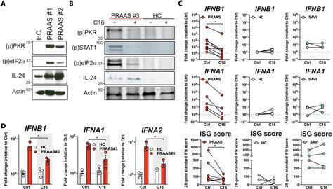 Protein Kinase R Is An Innate Immune Sensor Of Proteotoxic Stress Via