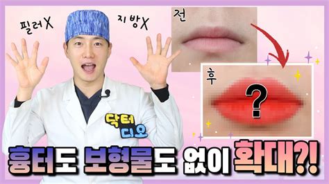 Eng입술성형 전세계 유일하게 보형물 없이 확대 가능한 곳 Youtube