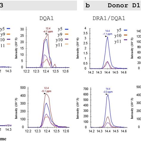 Ion Chromatograms Detecting Endogenous Top Panel And Spiked Stable