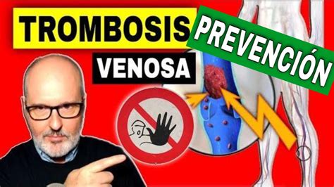 10 Pasos Para Evitar La Trombosis Venosa Profunda En Piernas Youtube