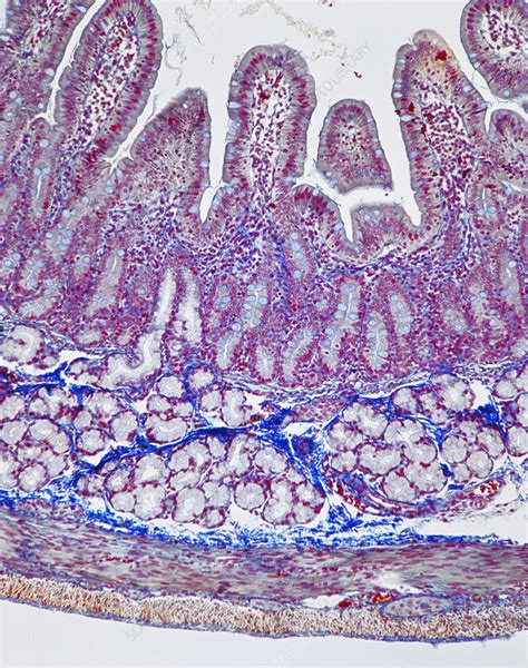 Human Duodenum Histology