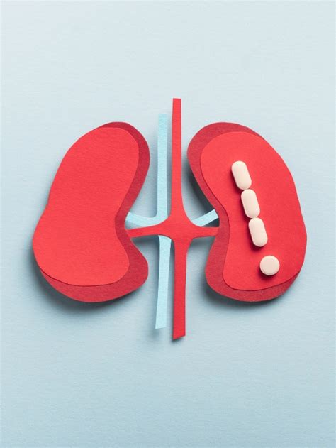 Risks of a Kidney Transplant - Vinita Health