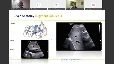 20201124 Efsumb Clevert Liver Us Video Sponsored By Samsung Youtube