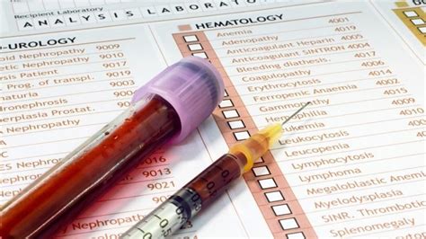 Blood test: transaminases and liver function - HealthCarter