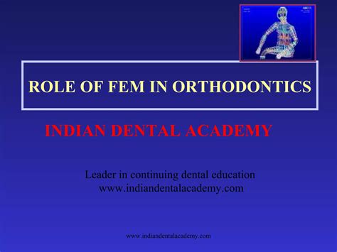 Role Of Fem In Orthodontics Certified Fixed Orthodontic Courses By Indian Dental Academy Ppt