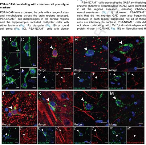 Psa Ncam Cell Morphologies And Double Labeling Of Psa Ncam With Cell