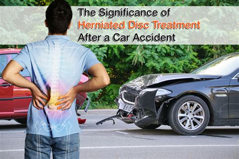 The Significance Of Herniated Disc Treatment After A Car Accident Galiny Accident Recovery