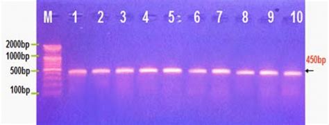 Agarose Gel Electrophoresis Image Shown The Pcr Product Analysis Of