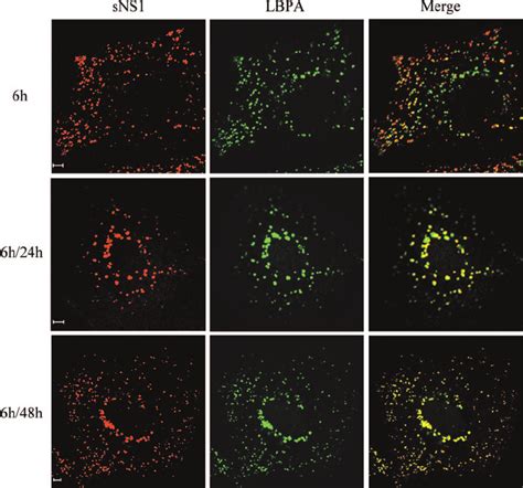 Sns Protein Accumulates In Lbpa Rich Structures Huh Cells Were