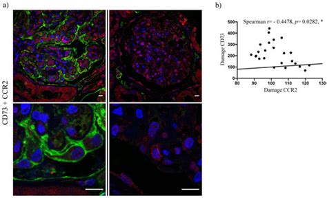 IJMS Free Full Text CD73 Overexpression In Podocytes A Novel