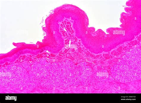 Human Esophagus Showing Non Keratinized Stratified Squamous Epithelium