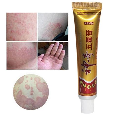 10pcs Skin Psoriasis Cream Dermatitis Eczematoid Eczema Ointment 限定価格セール