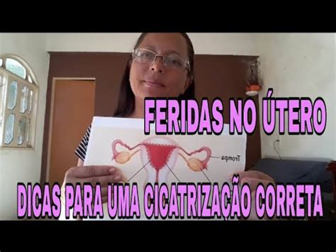 Feridas No Tero Dicas Para Uma Cicatriza O Correta Youtube