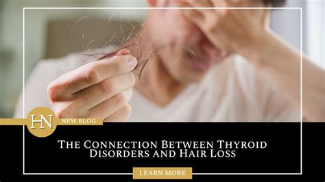 Connection Between Thyroid And Hair Loss Hairnation