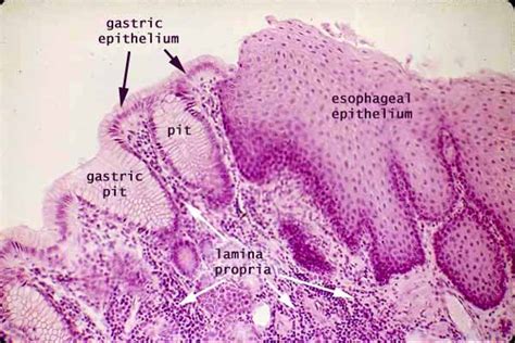 Esophagus Stomach Junction Histology Labeled