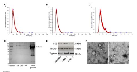 Figure 1 From Plasma Small Extracellular Vesicles From Dogs Affected By