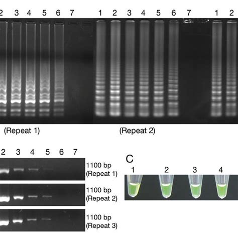 Comparison Of Sensitivity Between The A Loop Mediated Isothermal