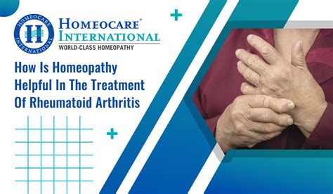 How Homeopathy Is Helpful In Treating Rheumatoid Arthritis