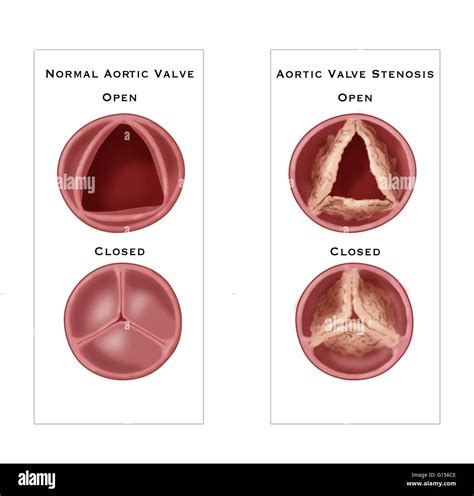 Heart Anatomy Aortic Valve