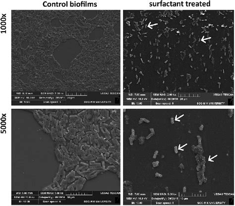 Sem Images Of Biofilm And Its Morphological Changes After Biosurfactant