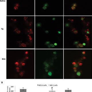 Intracellular localization of Aβ 42 in human platelets A Human