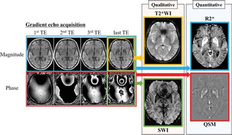 Quantitative Susceptibility Mapping Basic Methods And Clinical