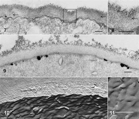 11 Transmission Electron Micrographs Of Cyst Walls Of Entamoeba Download Scientific Diagram