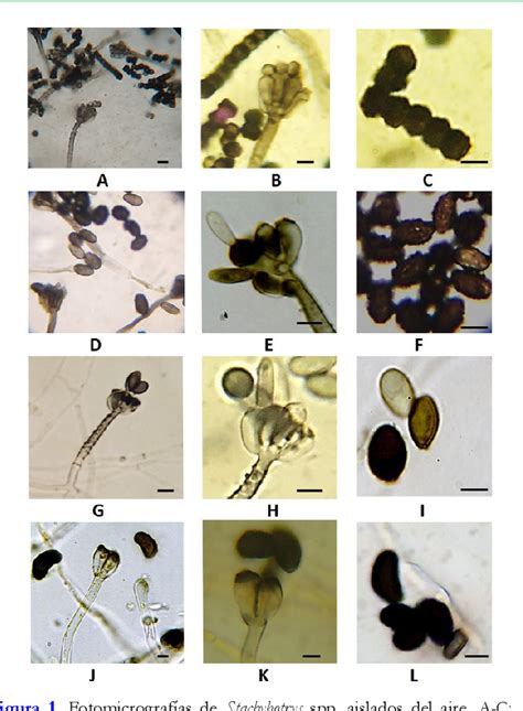 Figure 1 From Registros De Especies De Stachybotrys En El Aire De La