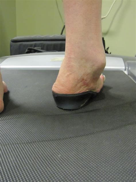 Foot Orthotic Therapy Blog