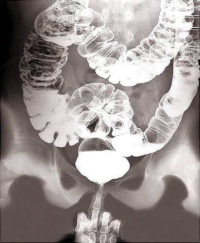 Sagittal Level 0302 As Mri Hot Sex Picture