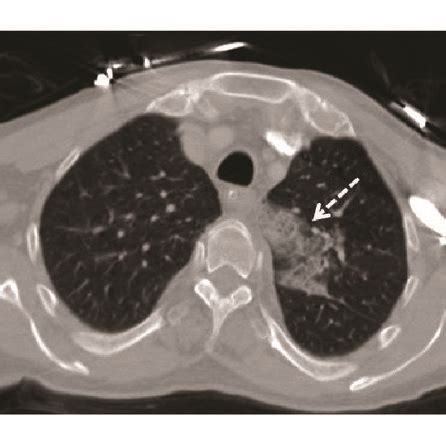 Case 1 Ac Case 2 Df Contrast Enhanced CT And Volume Rendering