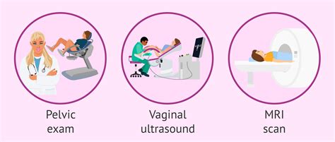 What is Adenomyosis? Risks, Symptoms and Treatment