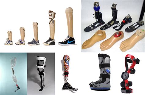 Orthotics and Prosthetics – Footorthotic