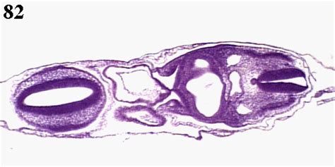48 Hour Chick Embryo Section 82 Unlabeled