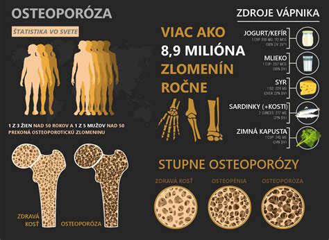 Osteopor Za Stupne Osteopor Zy Lie Ba A Vhodn Strava Zdravovek