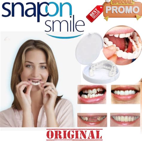 Jual Snap On Smile Sepasang Gigi Atas Dan Gigi Bawah Snap On Smile