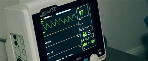 What Does an Abnormal EKG Look Like? - Causes, Symptoms