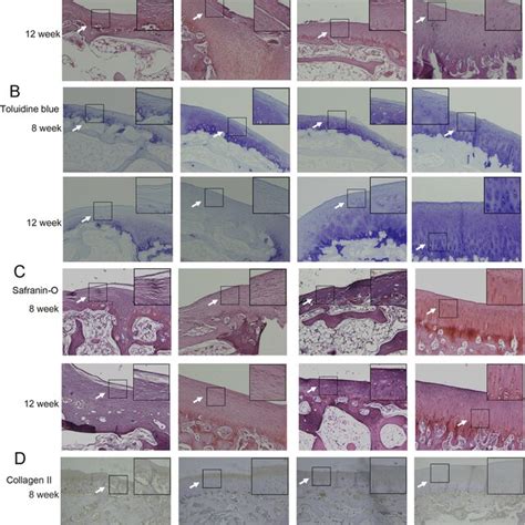 Ics Cssh Promoted The Regeneration Of Cartilage Defect Regeneration In