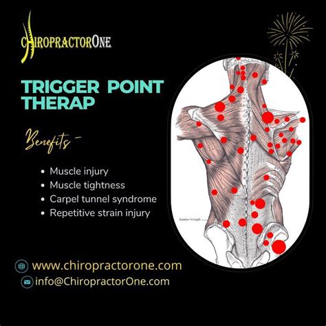 Trigger point therapy – Artofit