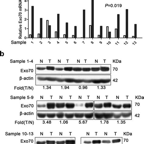 Real Time Pcr And Western Blot Analyses Of Exo Expression In Pairs