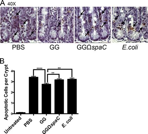 L Rhamnosus Gg Induced In Vivo Cellular Protection Is Spac Dependent