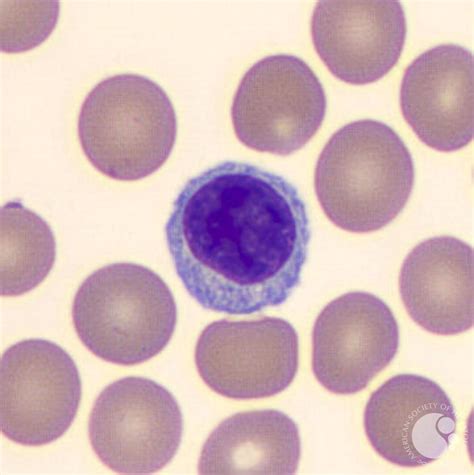 Lymphocyte