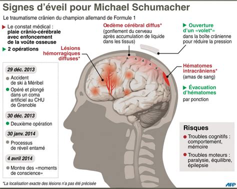 Michael Schumacher Le Point Sur Son état De Santé