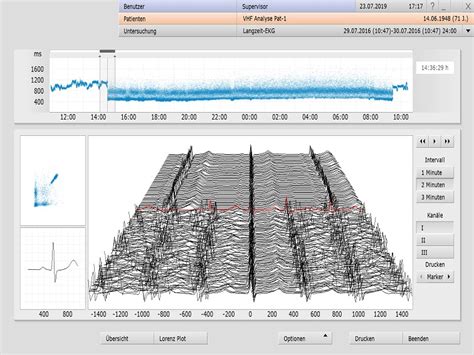 Kabelloser Langzeit Ekg Recorder Mit Innovativen Elektroden Schweizer