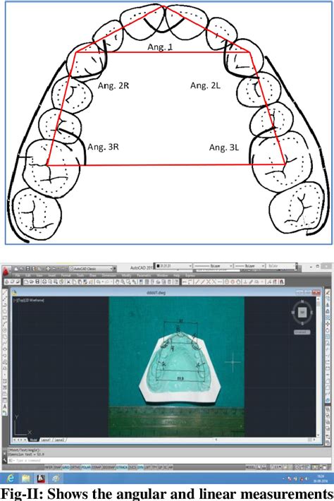 Table I From Relationship Between Vertical Facial Pattern And Dental Arch Forms In Skeletal