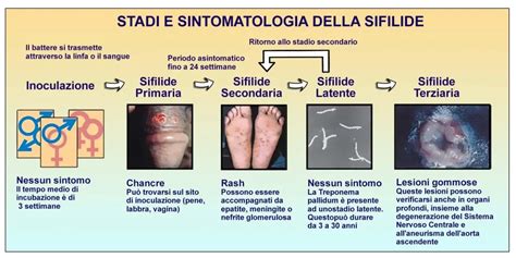 Sifilide Sintomi Stadi Trattamento Biomedic Center