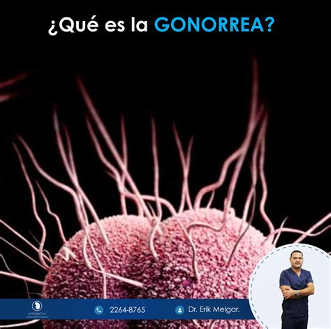 Urología Clinic - La gonorrea es una enfermedad de...