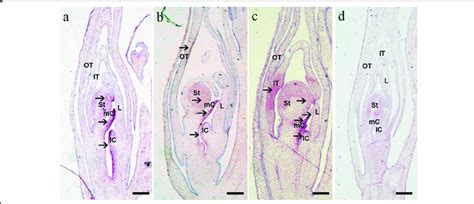 Rna In Situ Hybridization Detected By Csag1 Antisense Probe In Standard