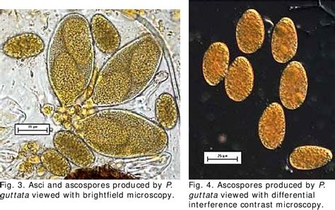 Figure From First Report Of Powdery Mildew On Corylus Avellana Caused