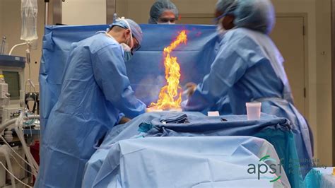 Apsf Preventing Surgical Fires Youtube